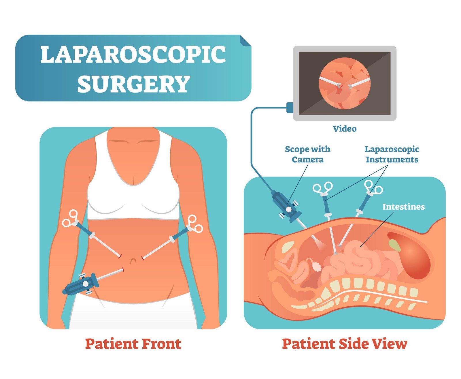 Hysteroscopy procedure for fertility enhancing surgeries